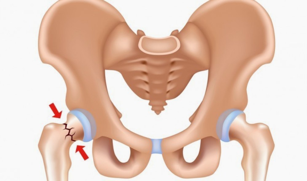Травми у літніх людей: ризики та своєчасна діагностика